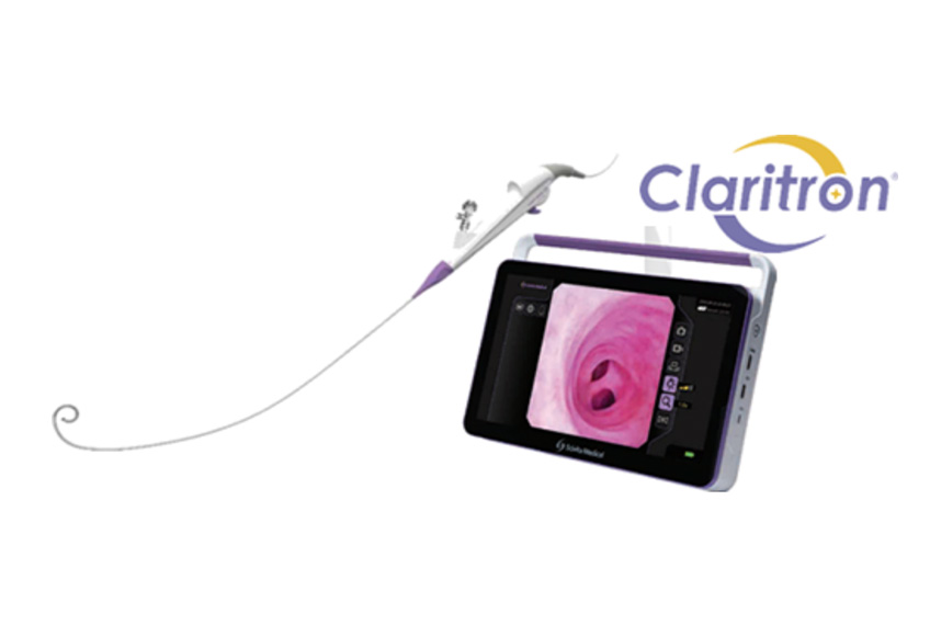 クラリトロン シングルユース尿管腎盂ビデオスコープ